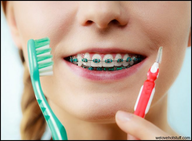 Oral Hygiene With Braces | Dr. Thomas Montemurno Orthodontics