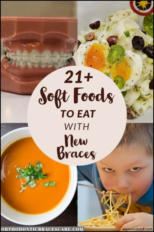 Soft Foods To Eat After Braces Tightening [With List] - Orthodontic ...